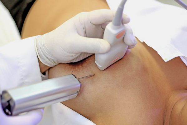 core-biopsy_8958ab2d