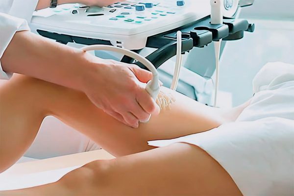 doppler-vascular-catete-convenios-e-particulares